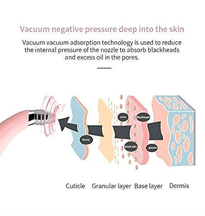 Blackhead Cosmetology Apparatus – Rechargeable Facial Suction Tool