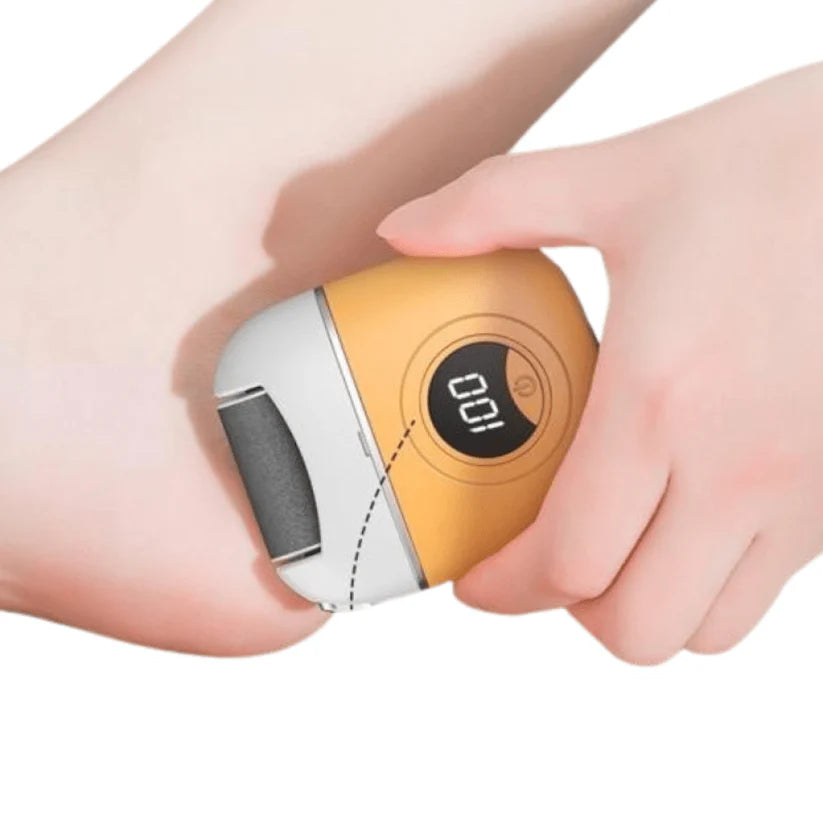 DENX DX3705 Foot Polisher – Rechargeable Callus & Dead Skin Remover
