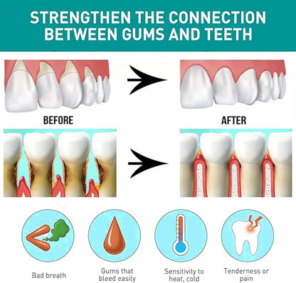 Eelhoe Mouth Relief Spray – Herbal Gum Pain, Ulcer & Sensitivity Relief (25ml)