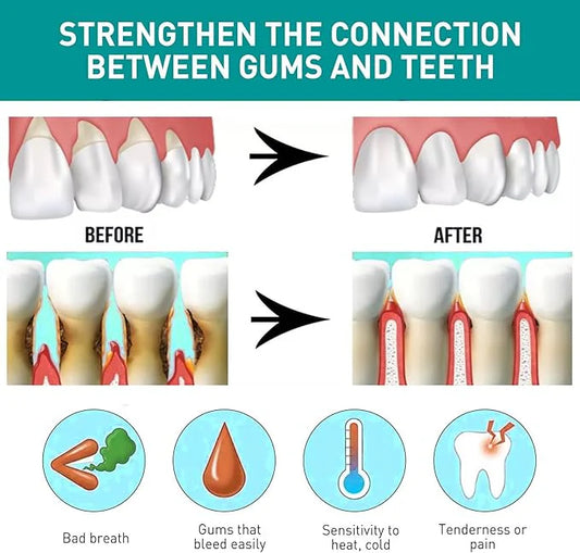 Eelhoe Mouth Relief Spray – Herbal Gum Pain, Ulcer & Sensitivity Relief (25ml)