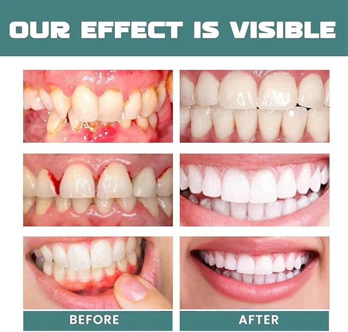 Eelhoe Mouth Relief Spray – Herbal Gum Pain, Ulcer & Sensitivity Relief (25ml)