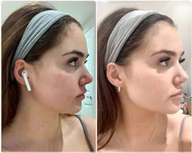 Face Massager – USB Rechargeable Skincare Device with 4 Heads for Puffiness & Glow