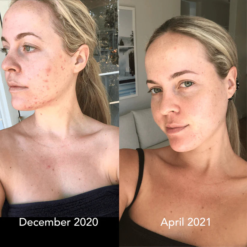 Face Massager – USB Rechargeable Skincare Device with 4 Heads for Puffiness & Glow