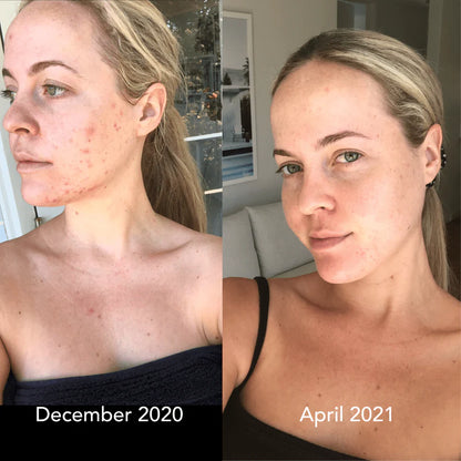 Face Massager – USB Rechargeable Skincare Device with 4 Heads for Puffiness & Glow