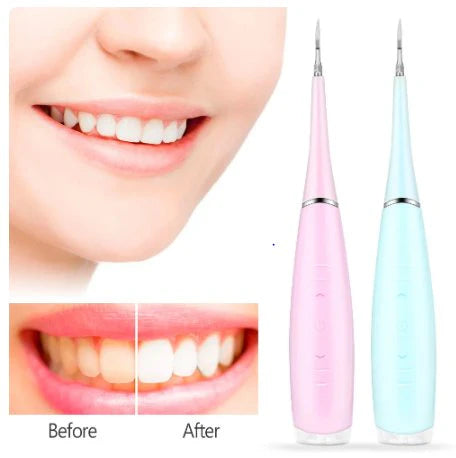 Portable Electric Sonic Dental Scaler – Rechargeable Home Teeth Cleaning Device