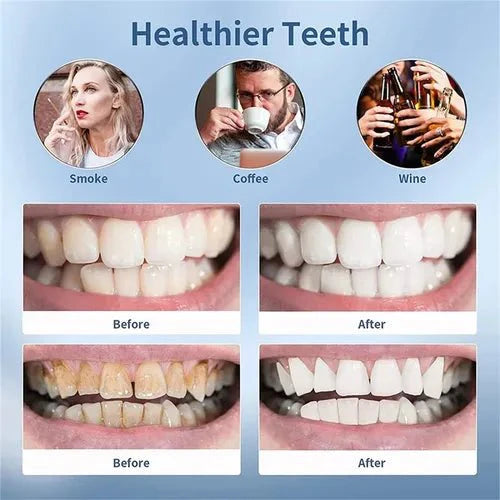 Smart Ultra-Sonic Teeth Cleaner – Rechargeable Electric Dental Plaque & Tartar Remover with LED Display