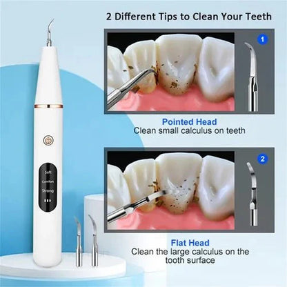 Smart Ultra-Sonic Teeth Cleaner – Rechargeable Electric Dental Plaque & Tartar Remover with LED Display