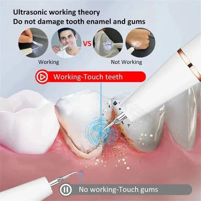 Smart Ultra-Sonic Teeth Cleaner – Rechargeable Electric Dental Plaque & Tartar Remover with LED Display