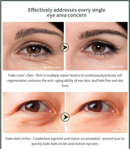 Time Eraser Eye Essence Oil 10ml – Reduce Fine Lines & Refresh Tired Eyes